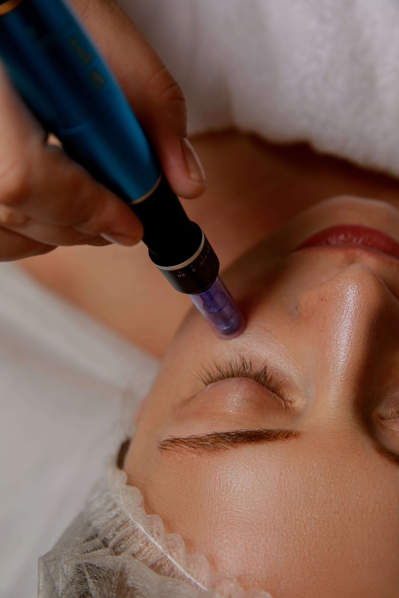 VAMPIRE FACIAL / DERMAPEN + PRP/