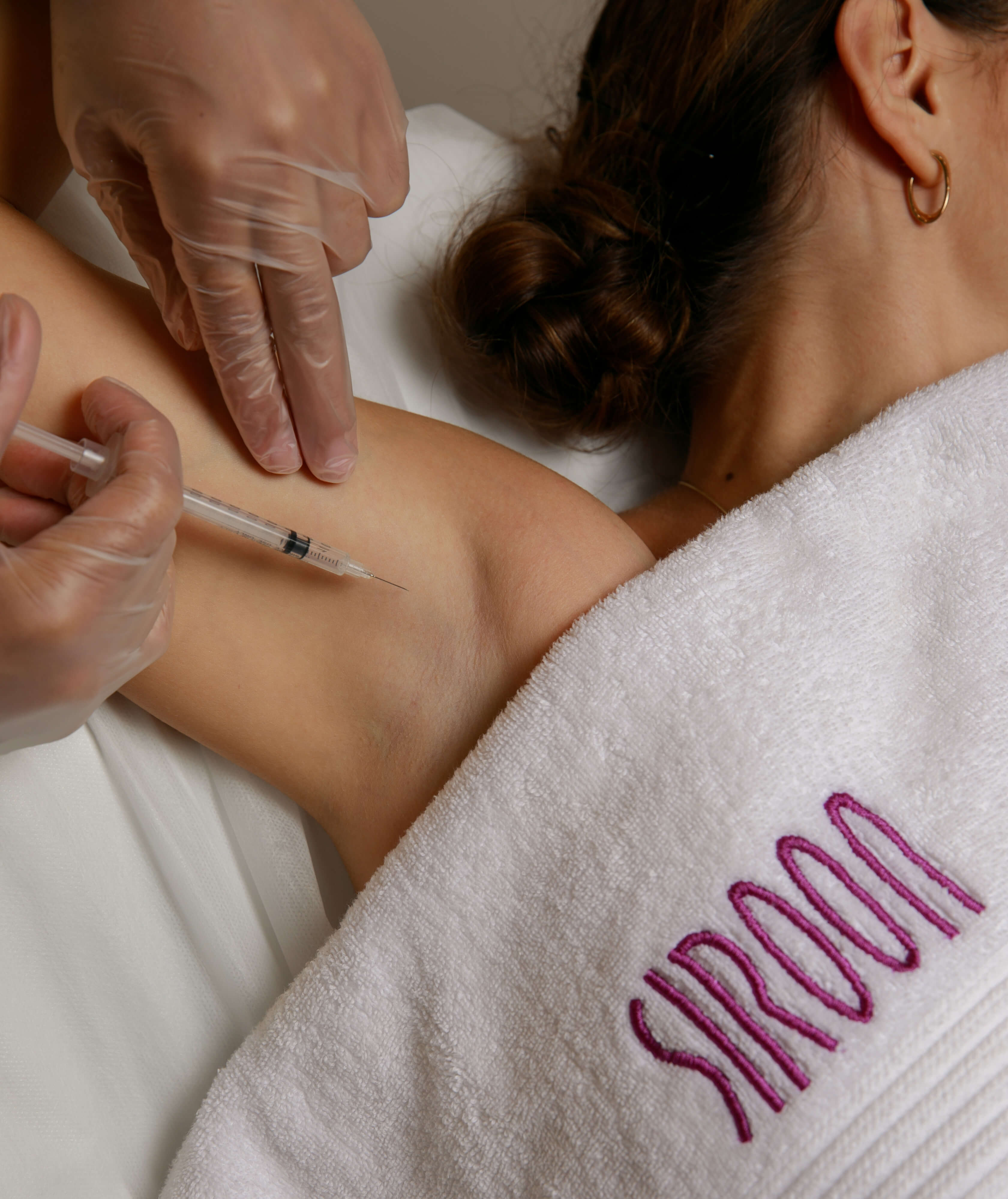 BOTULINUM TOXIN |  HYPERHIDROSIS TREATMENT 1 AREA