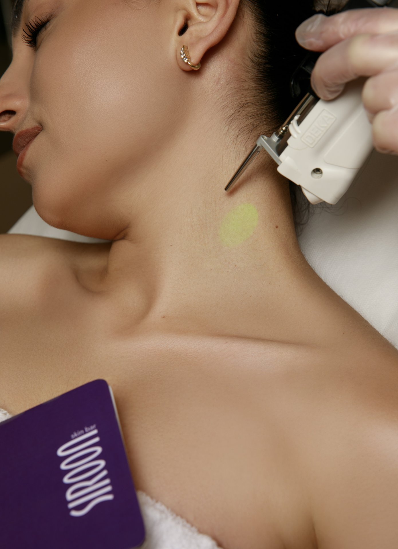 LASER DEKA MOTUS AX | NECK FRONT