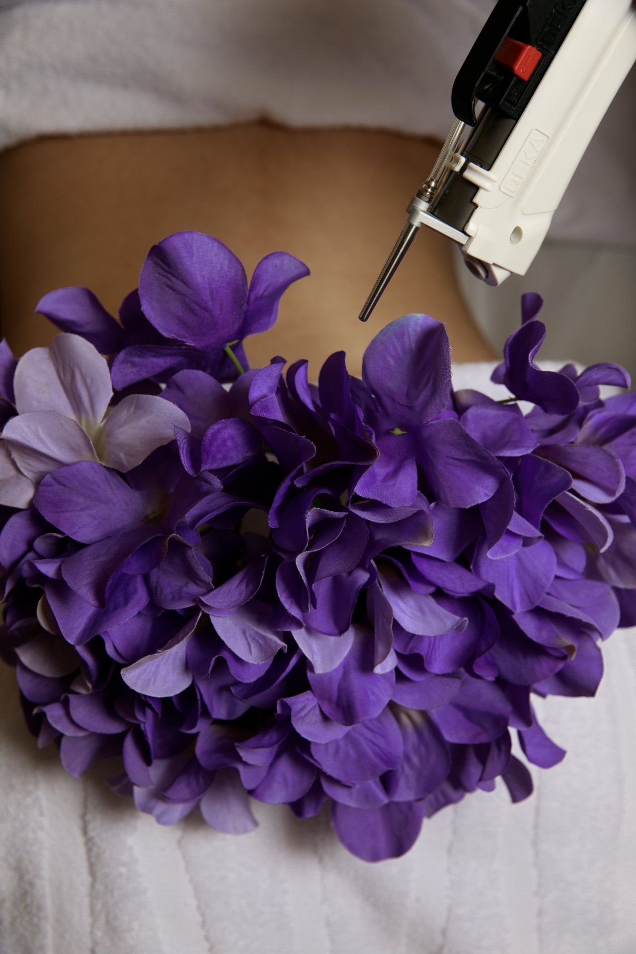 LASER DEKA MOTUS AX | BUTTUCKS