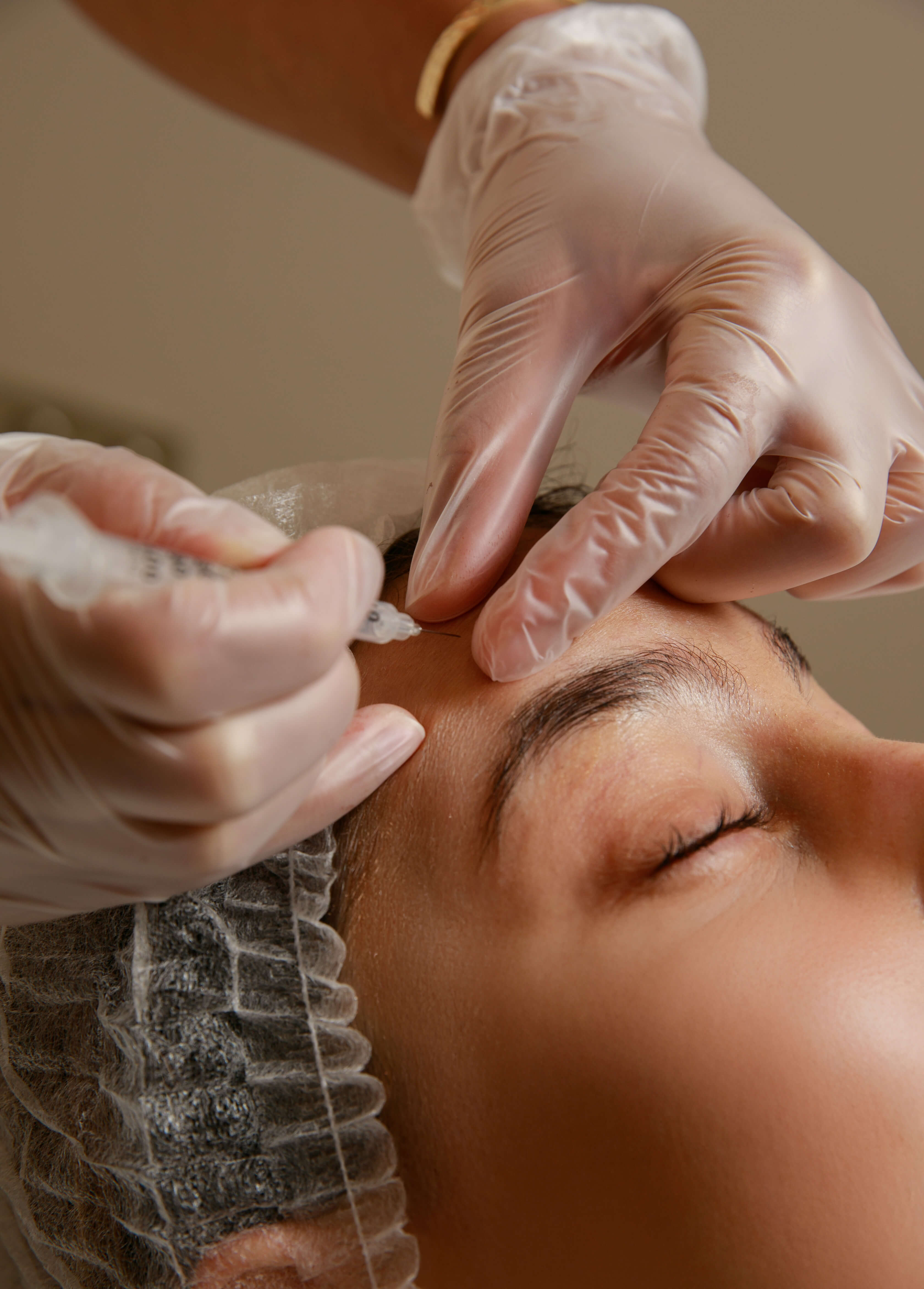 BOTULINUM TOXIN |  3 ZONE