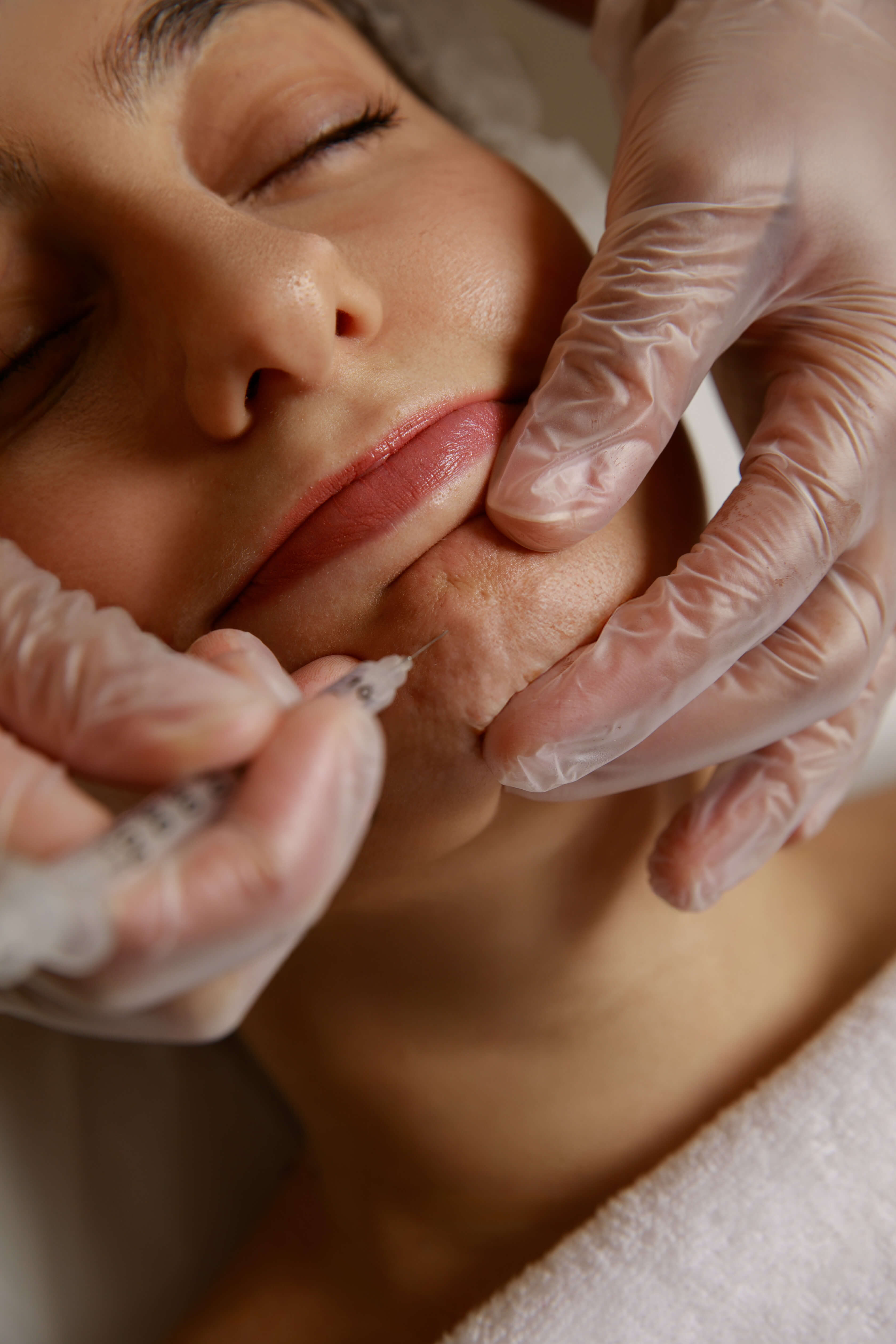 CHIN / GUMMY SMILE CORRECTION SIROON MINAS, MD