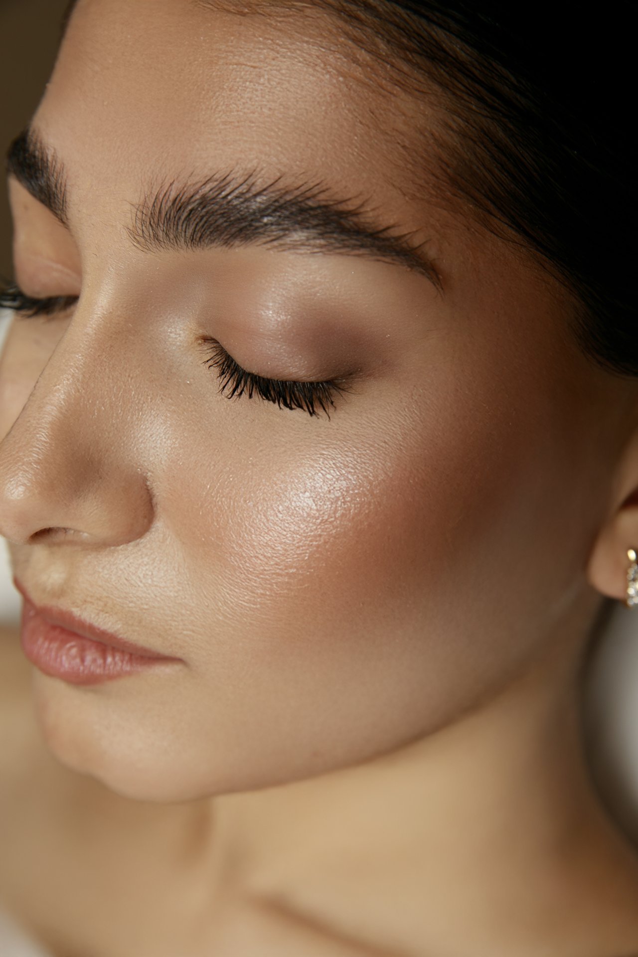 IPL THERAPY 10 VISITS