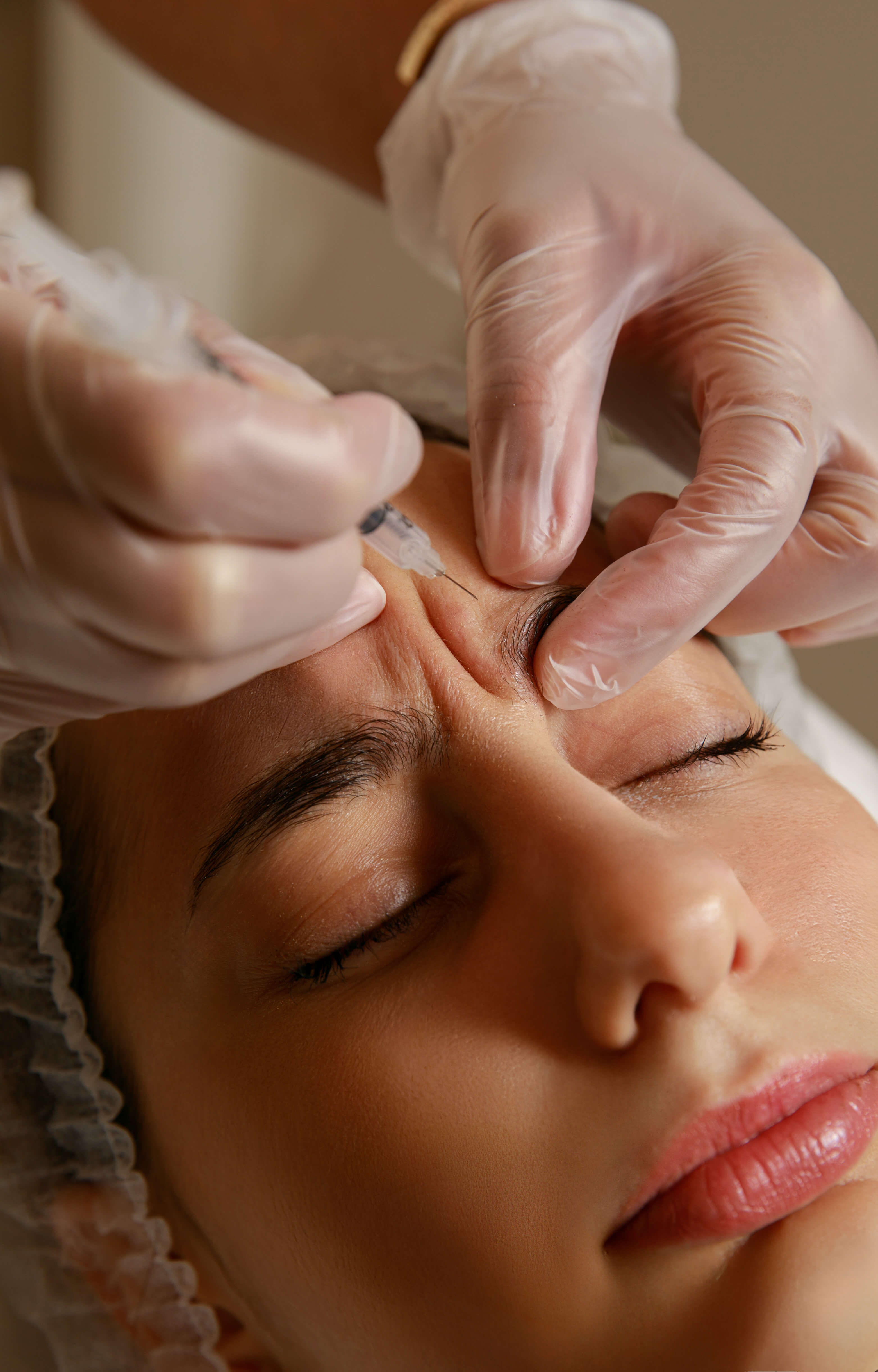 BOTULINUM TOXIN |  3 ZONE